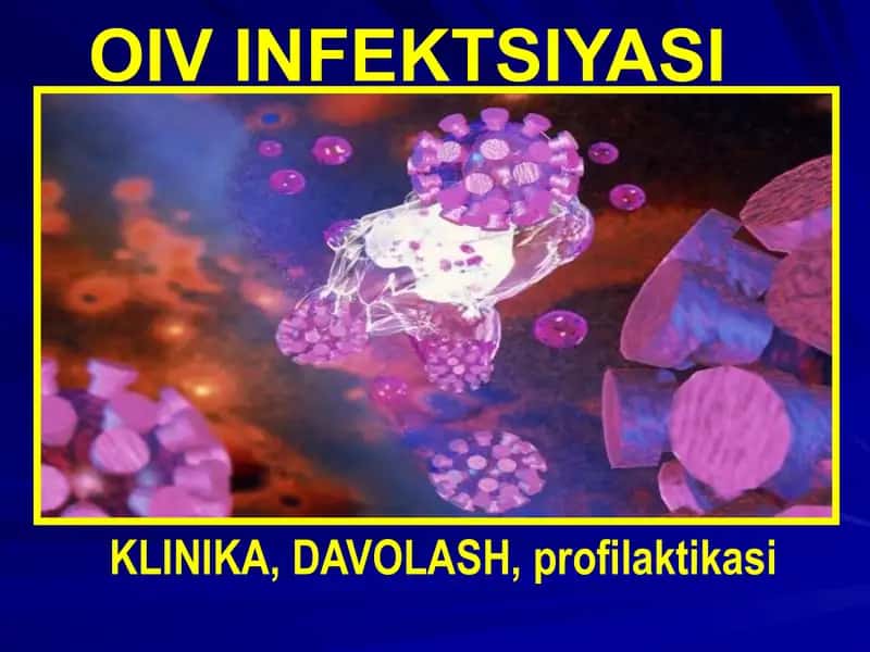 OIVINFEKTSIYASI