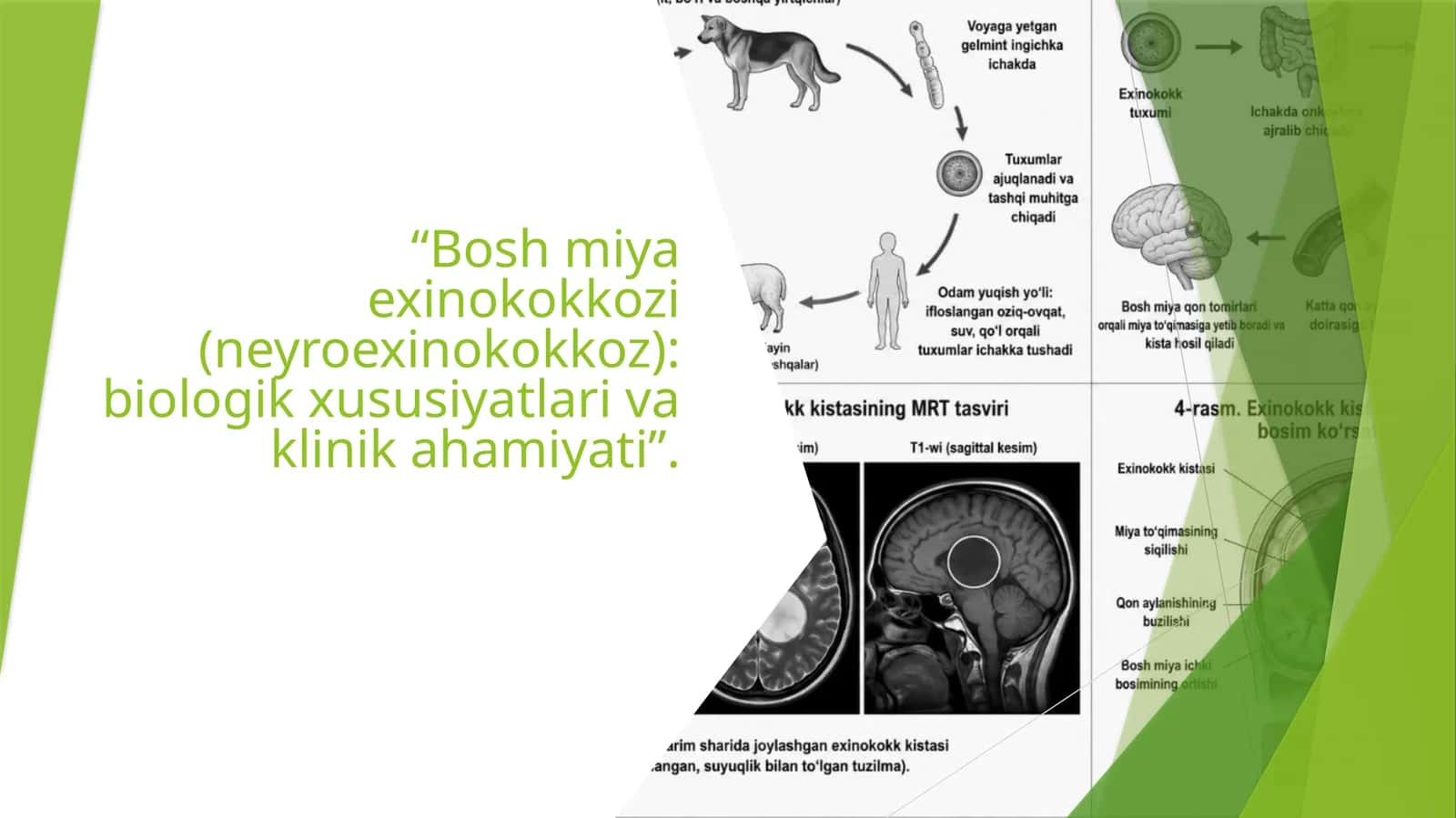 Bosh miya exinokokkozi (neyroexinokokkoz) biologik xususiyatlari va klinik ahamiyati”
