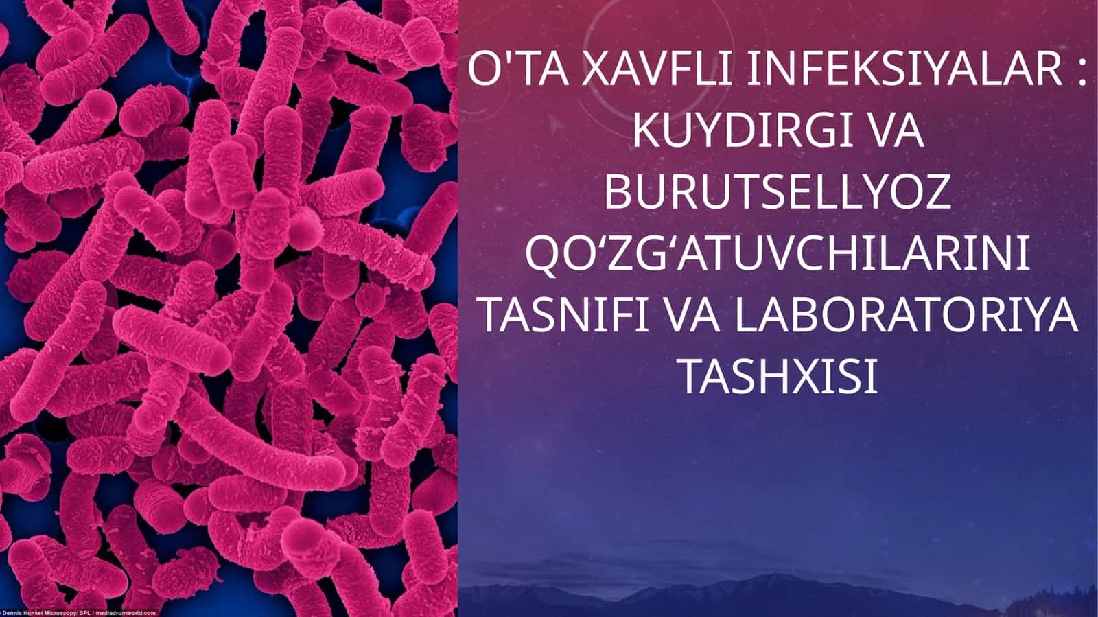 O'ta xavfli infeksiyalar Kuydirgi va burutsellyoz qoʻzgʻatuvchilarini tasnifi va laboratoriya tashxisi