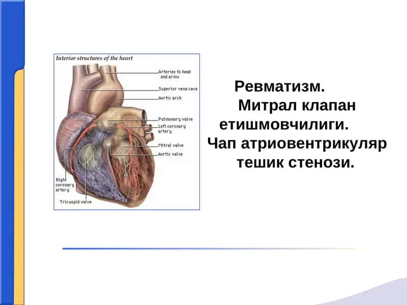 Ревматизм. Митрал клапан етишмовчилиги.Чап атриовентрикуляр тешик стенози.