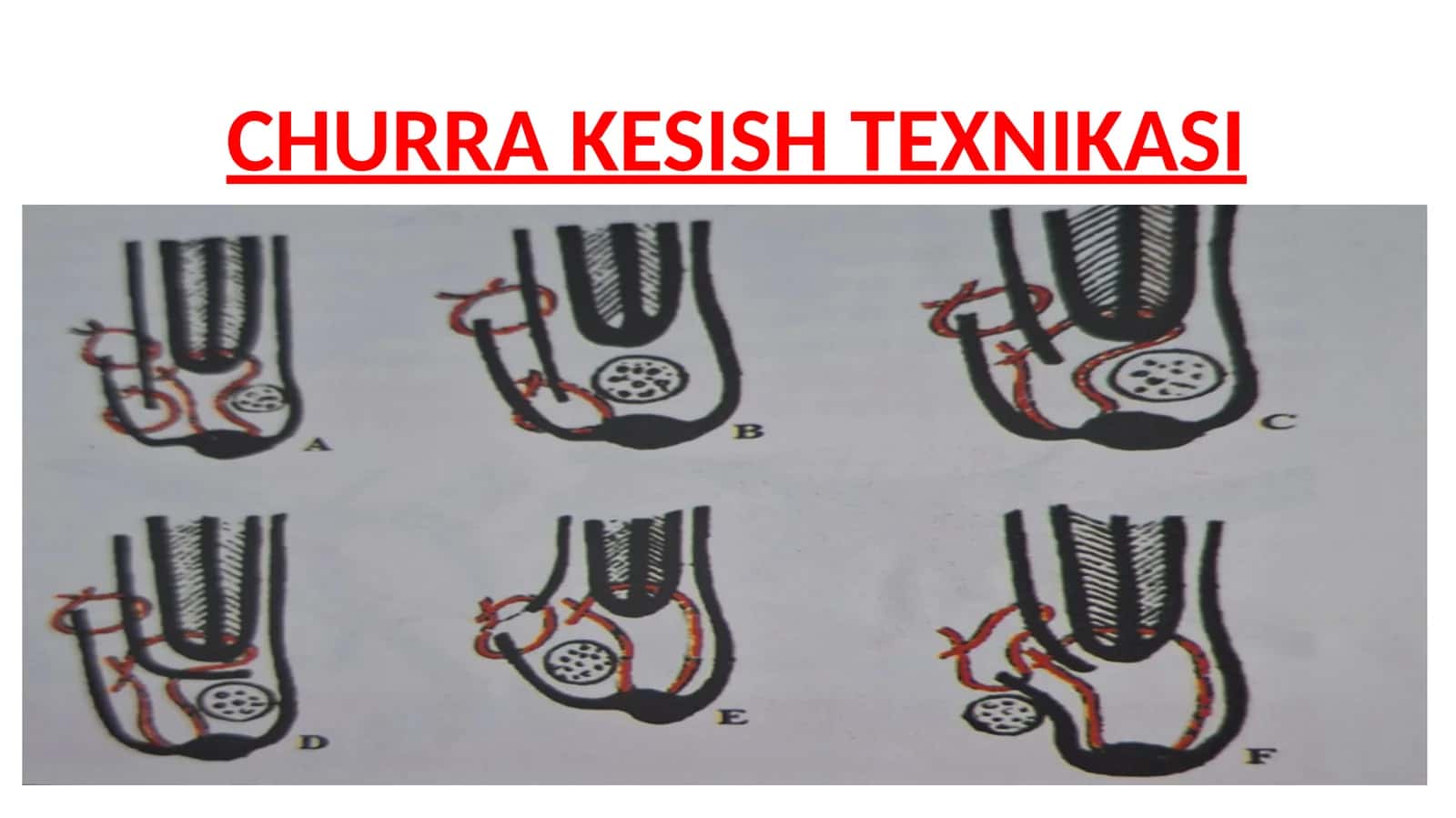 CHURRA KESISH TEXNIKASI