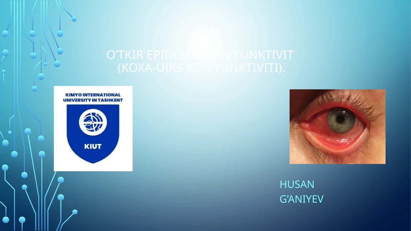 O’tkir epidemik kon’yunktivit(Koxa-Uiks kon’yunktiviti)