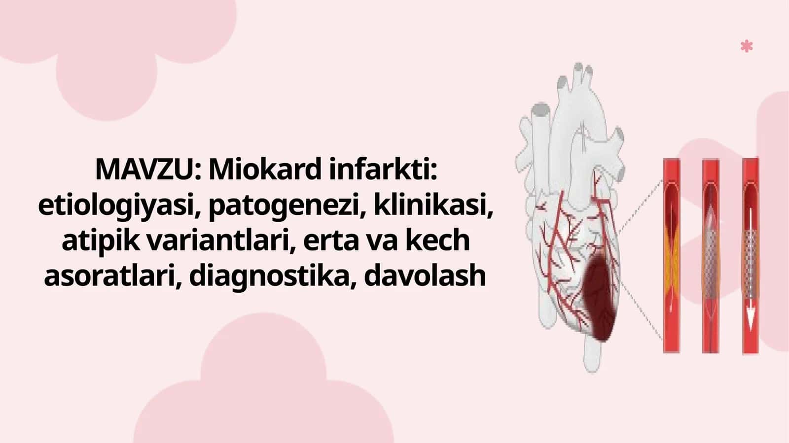 Miokard infarkti