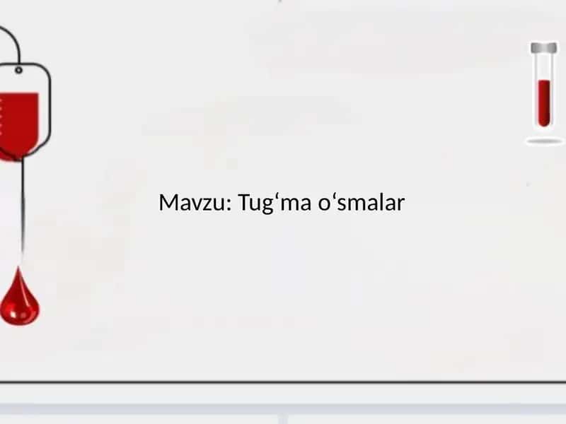 Tug'ma o'smalar