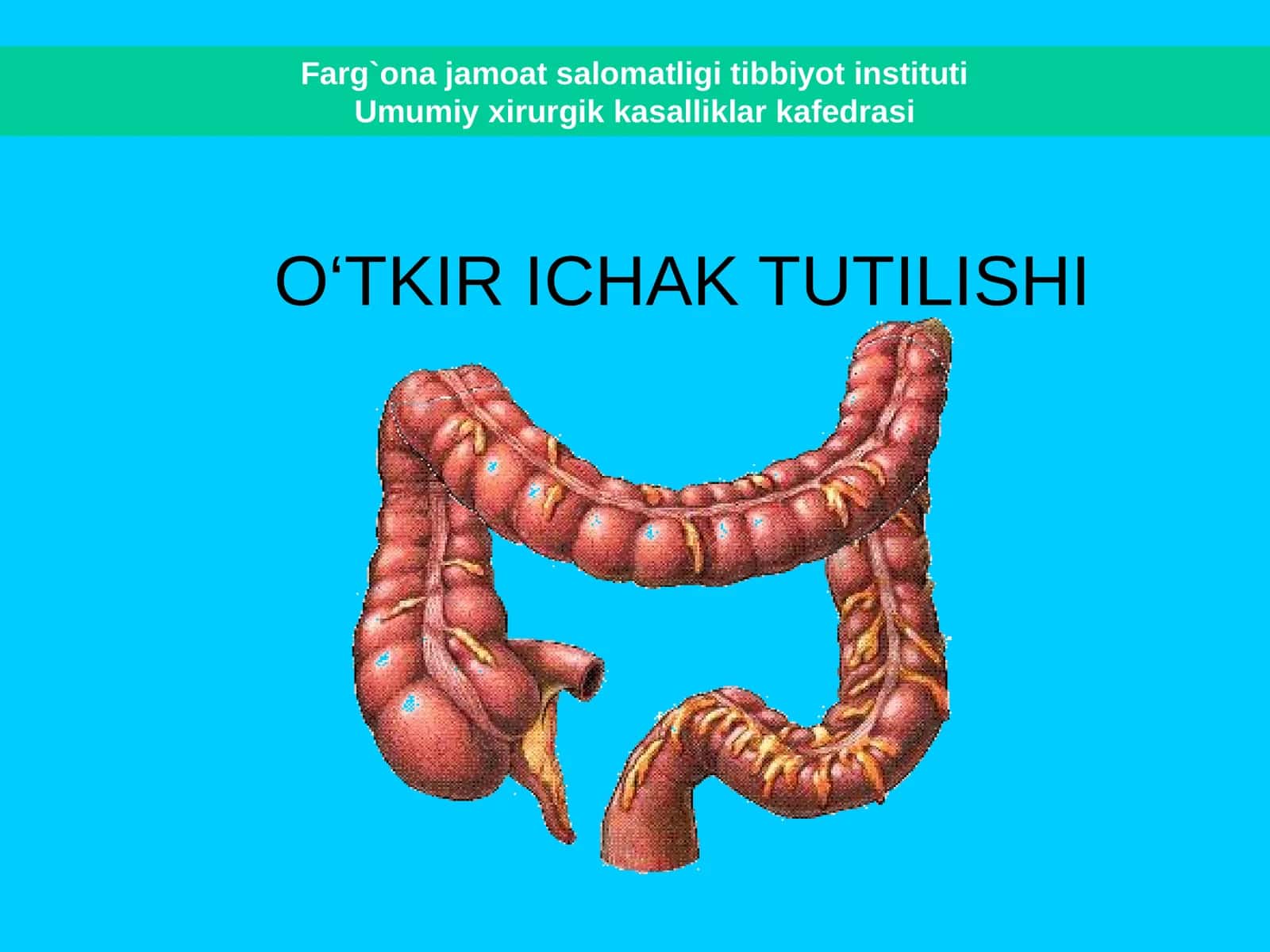 O‘TKIR ICHAK TUTILISHI