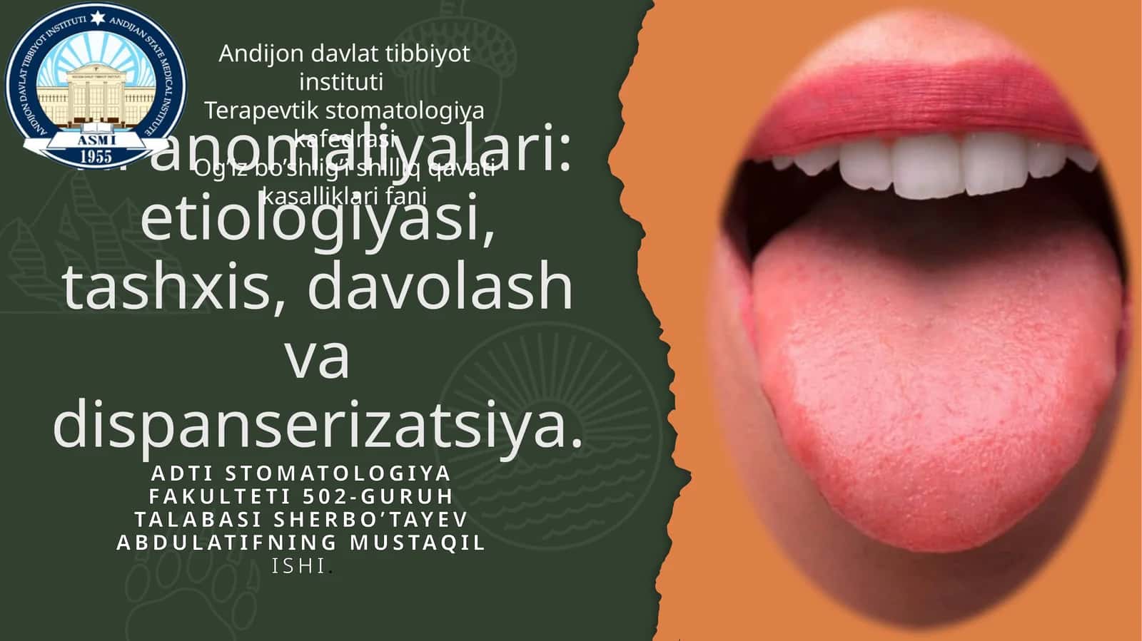 Til anomaliyalari: etiologiyasi, tashxis, davolash va dispanserizatsiya.