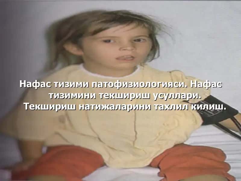Астма