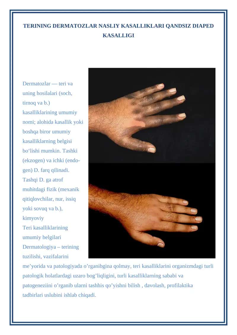 TERINING DERMATOZLAR NASLIY KASALLIKLARI QANDSIZ DIAPED KASALLIGI