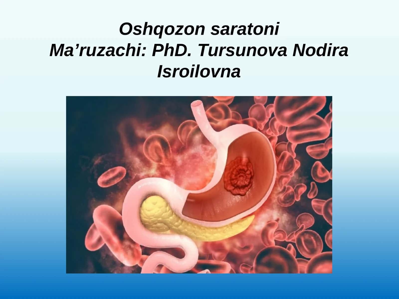 Oshqozon saraton