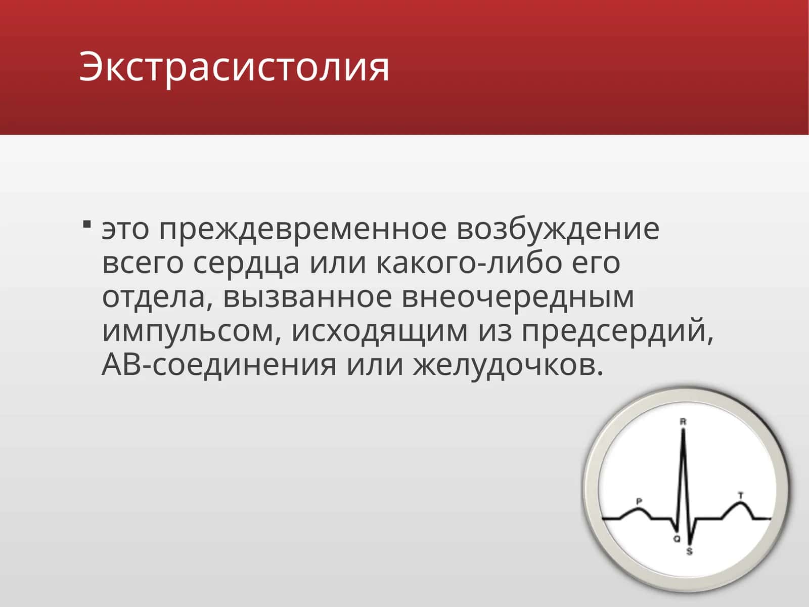 Экстрасистолия