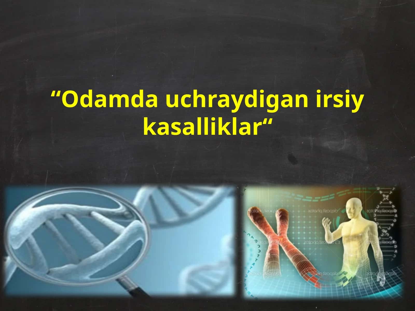 Odamda uchraydigan irsiy kasalliklar