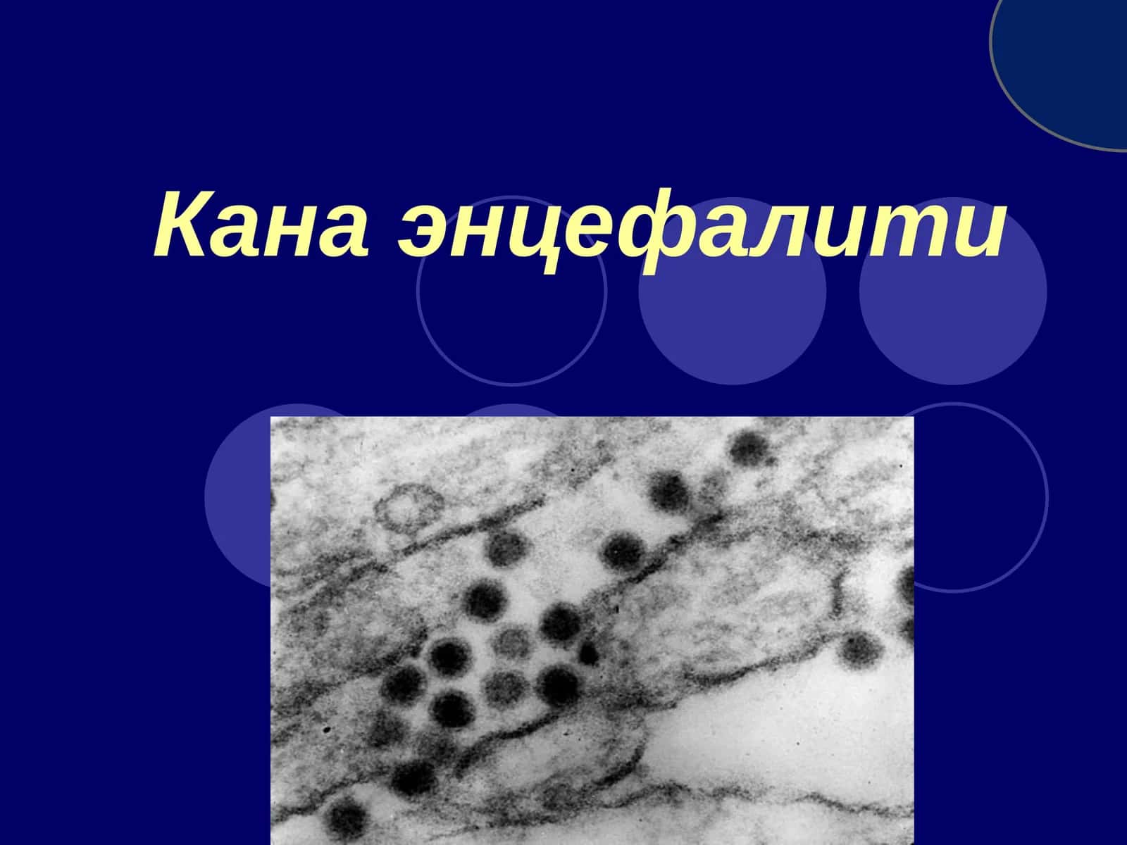 Кана энцефалити