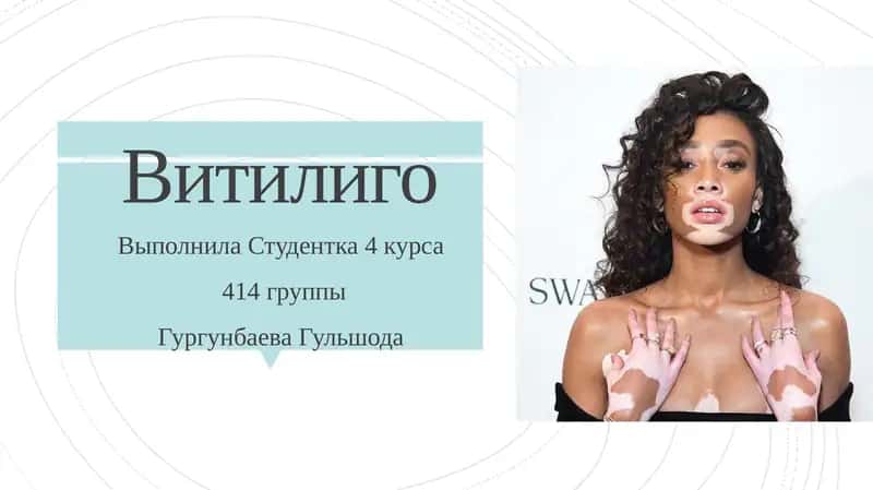 Витилиго