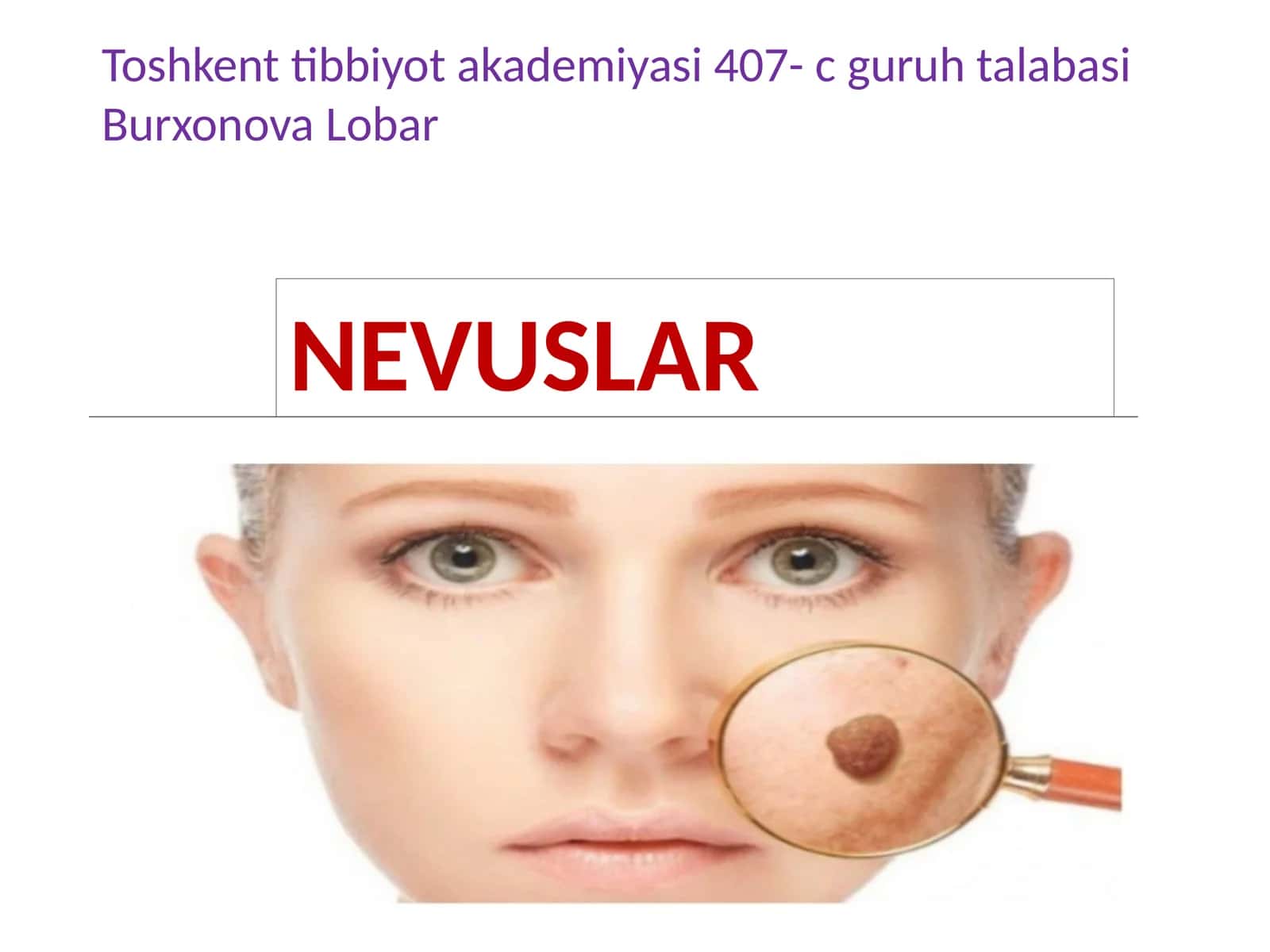 NEVUSLAR