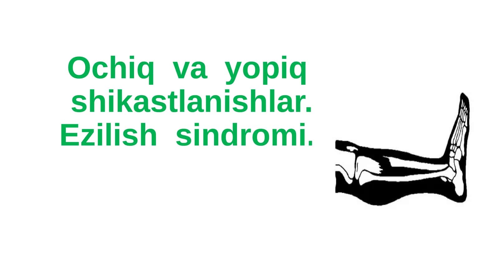 Ochiq va yopiq shikastlanishlar, Ezilish sindromi