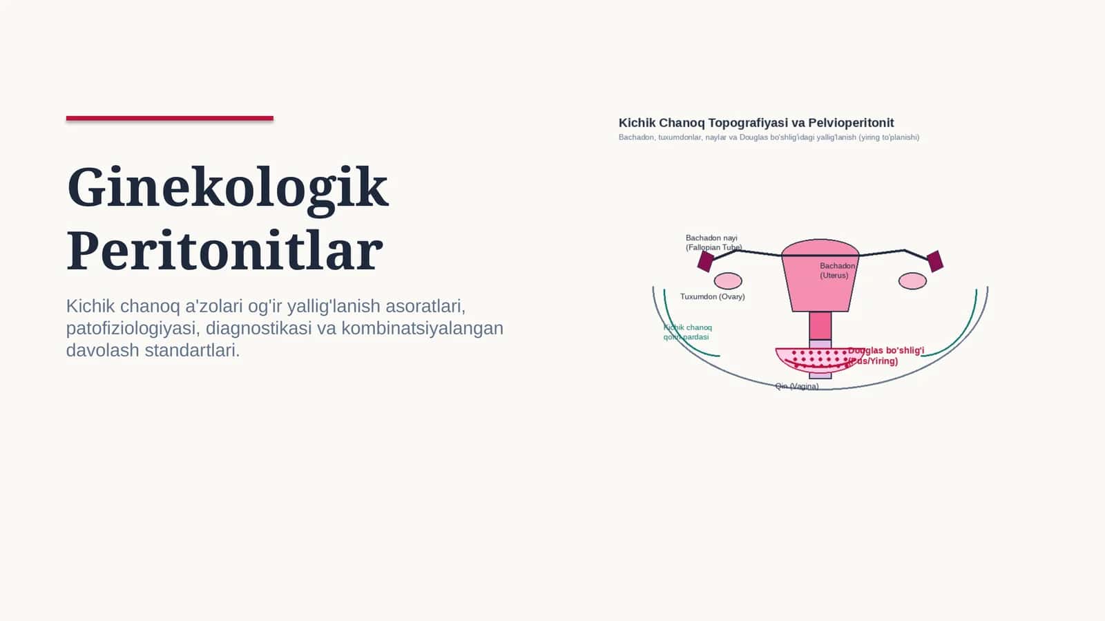 Ginekologik peritonitlar — 15 slaydli professional tibbiy taqdimot | Ginekologiya va akusherlik