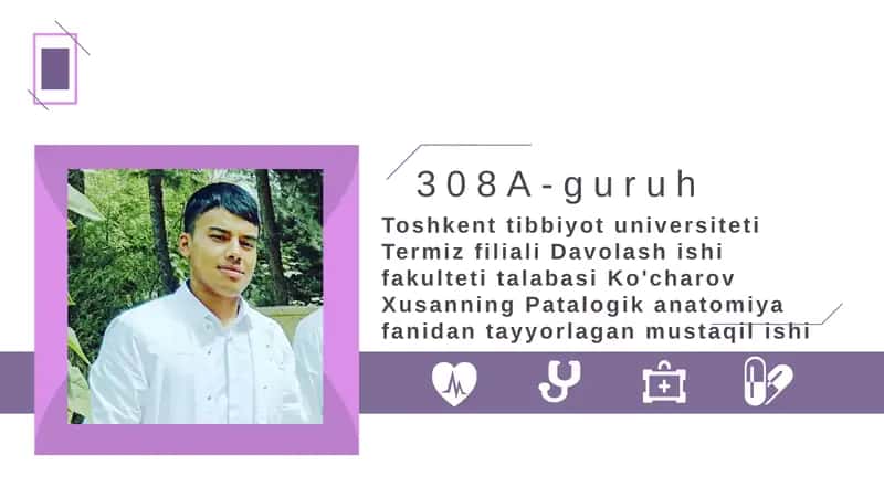 Mavzu:Uveit. Katarakta. Retinopatiyalar. To'r parda o'smalari. Ko'ruv nerv patologiyaları.