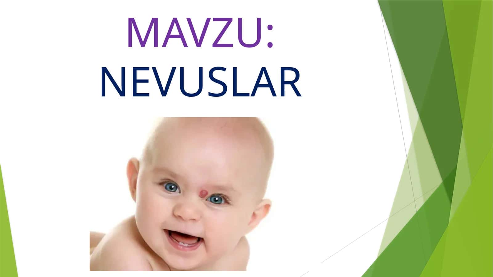 NEVUSLAR