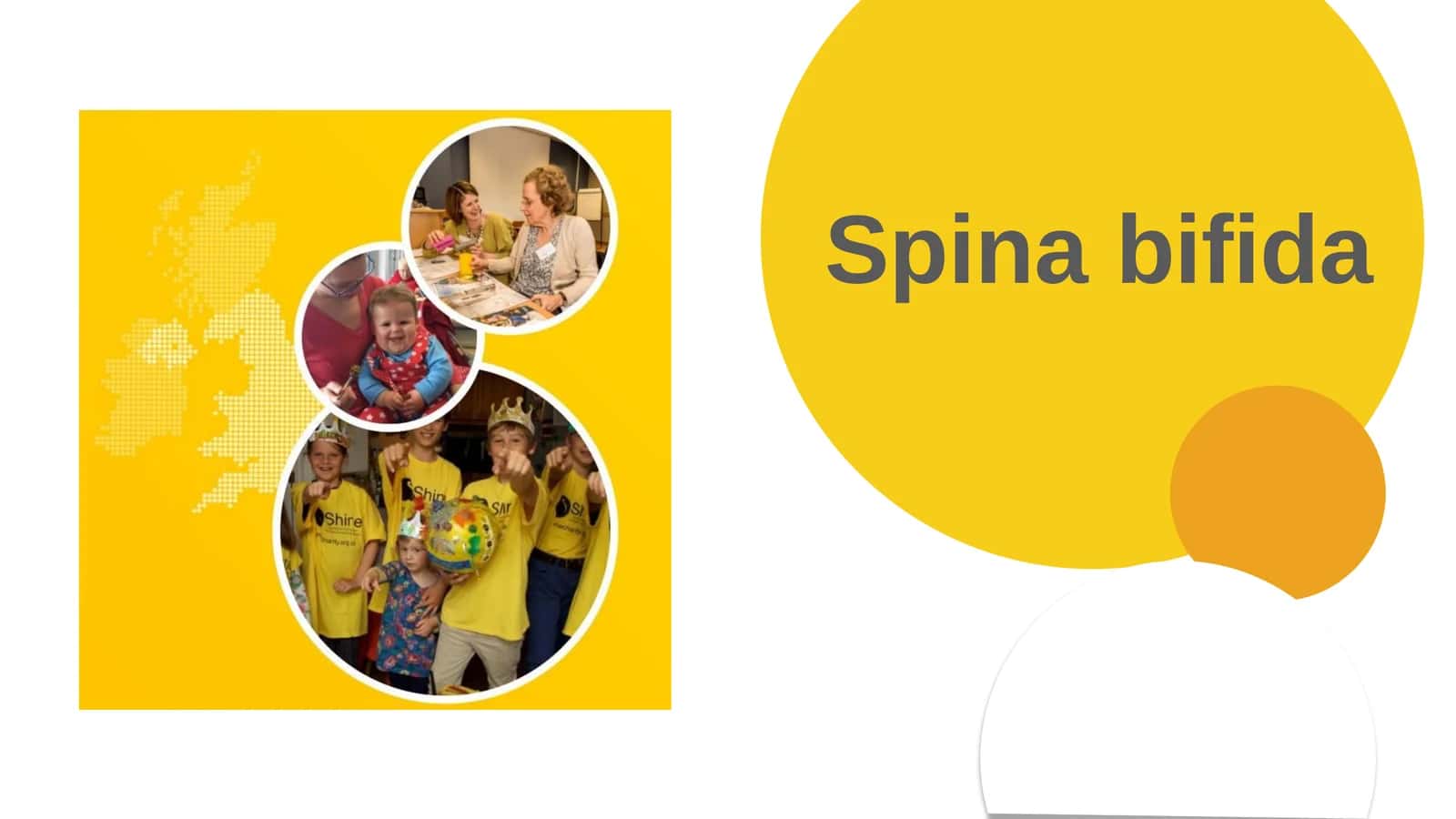 Spina bifida