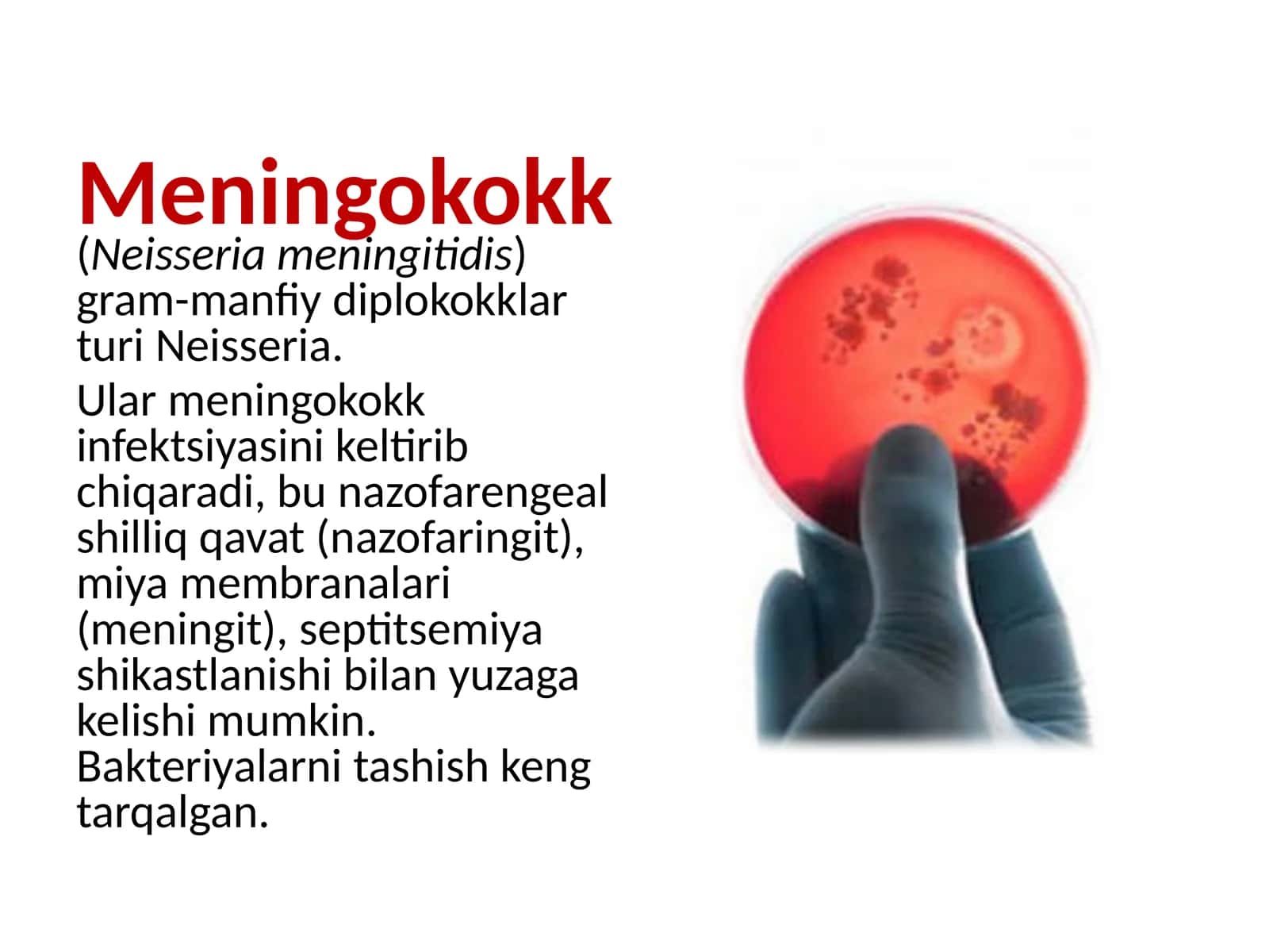 Meningokokk(Neisseria meningitidis)