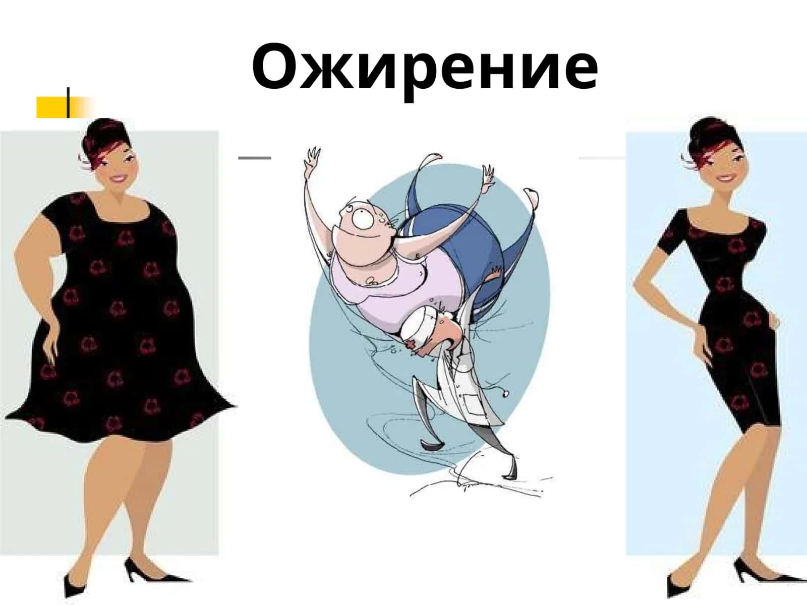 Ожирение