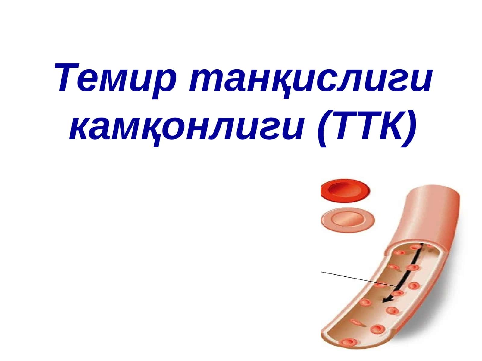 Темир танқислиги камқонлиги(ТТК)