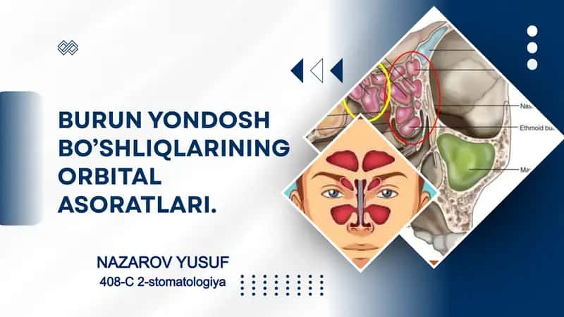 BURUN YONDOSH BO’SHLIQLARINING ORBITAL ASORATLARI