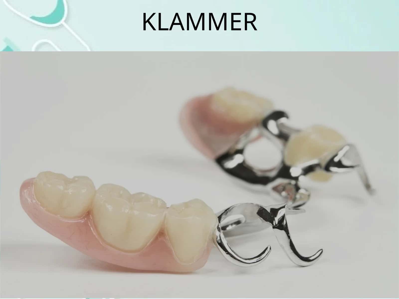 Klammer