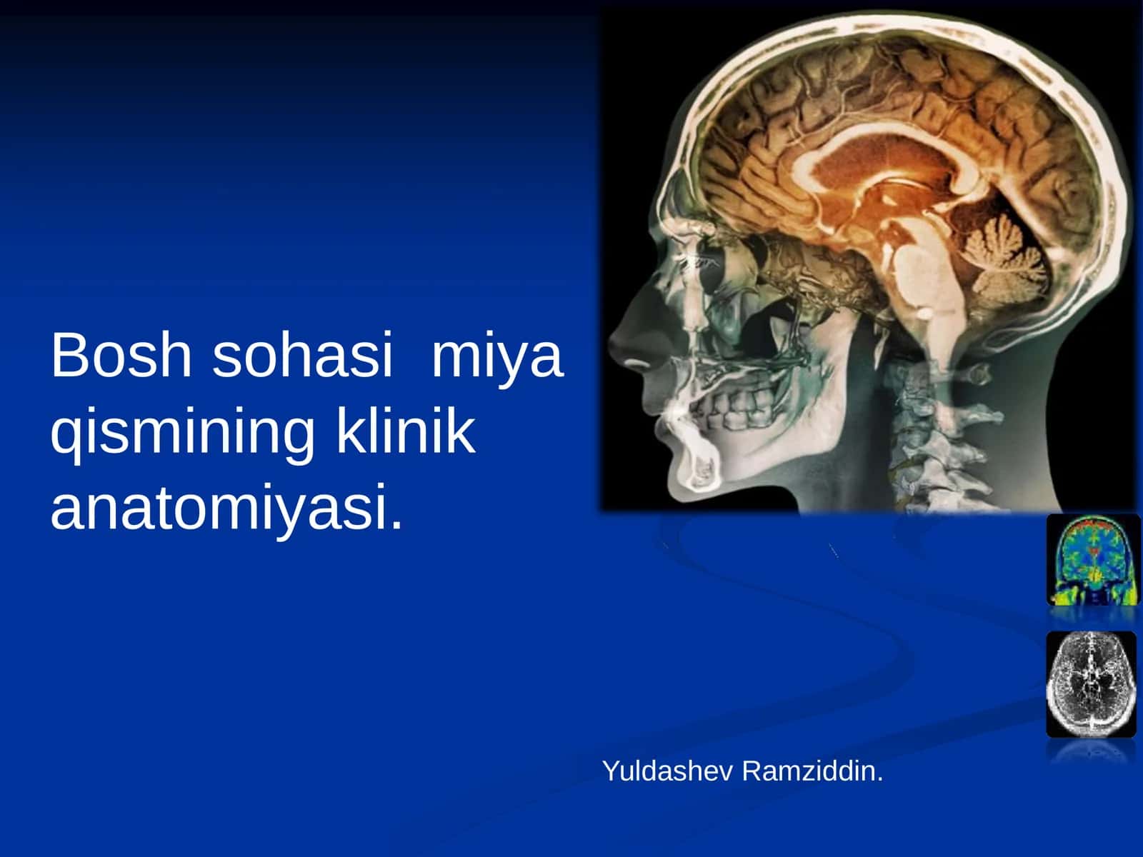 Bosh sohasi miya qismining klinik anatomiyasi