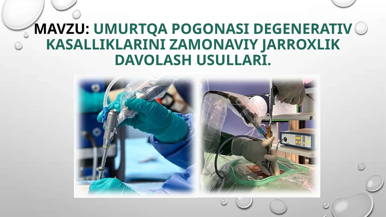 Umurtqapogonasidegenerativkasalliklarini zamonaviyjarroxlikdavolash usullari