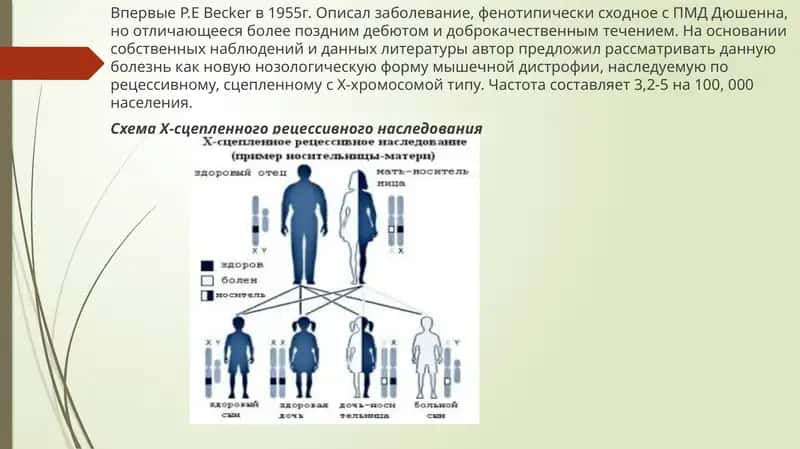 Прогрессирующая мышечная дистрофия Беккера