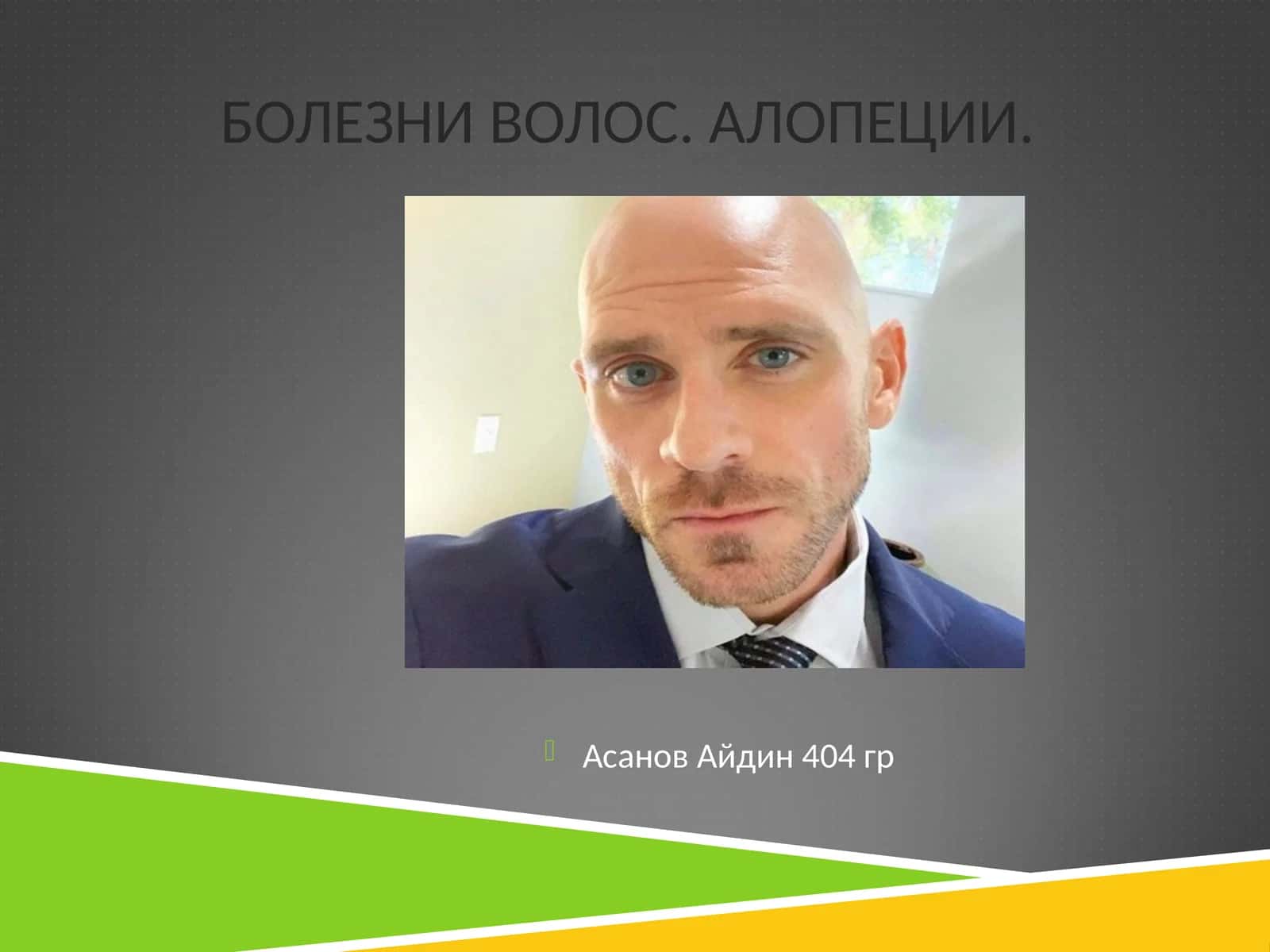 КЛАССИФИКАЦИЯ АЛОПЕЦИЙ