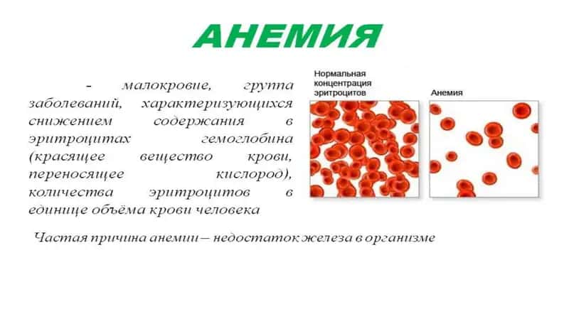 ANEMIYA