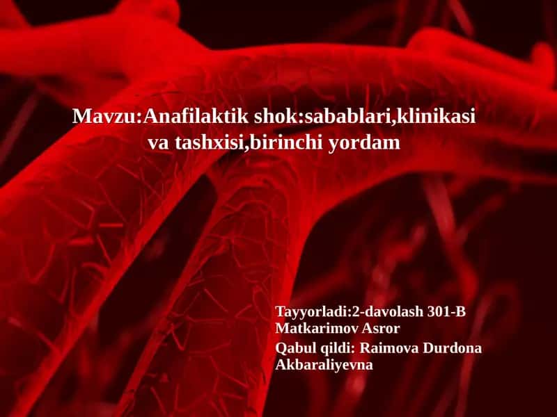 Anafilaktik shok