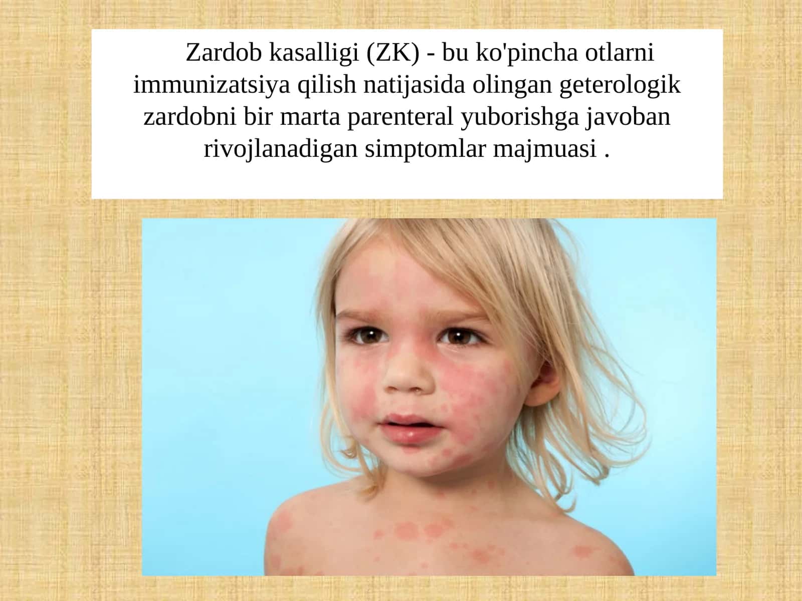 Zardobkasalligi (ZK)