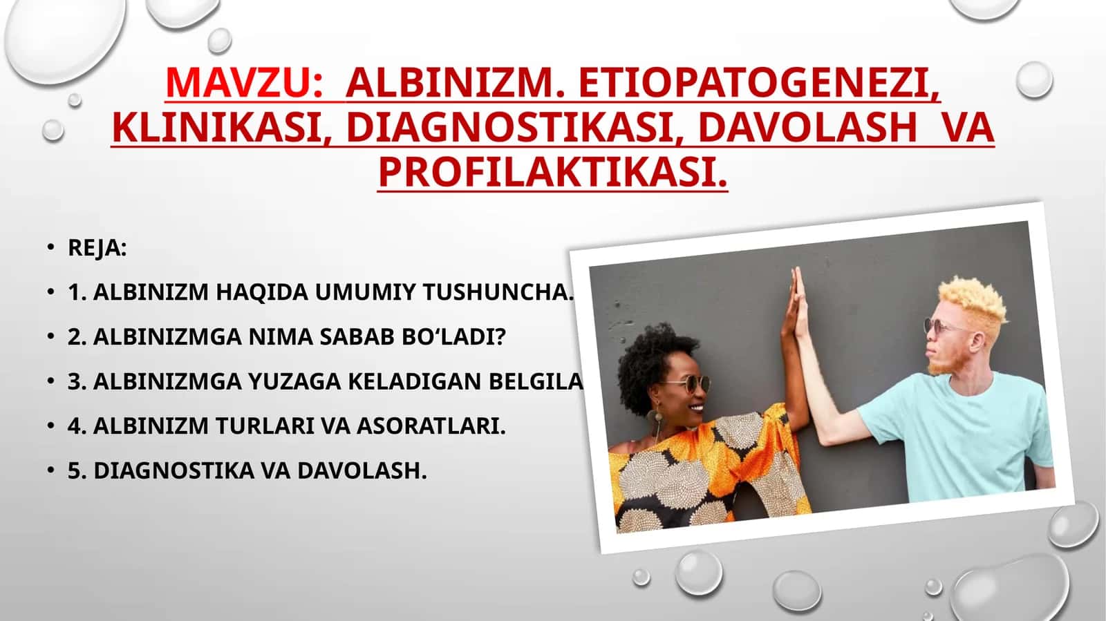 Albinizm. Etiopatogenezi, klinikasi, diagnostikasi, davolash va profilaktikasi