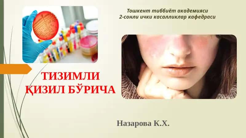 Тизимли Қизил Бўрича