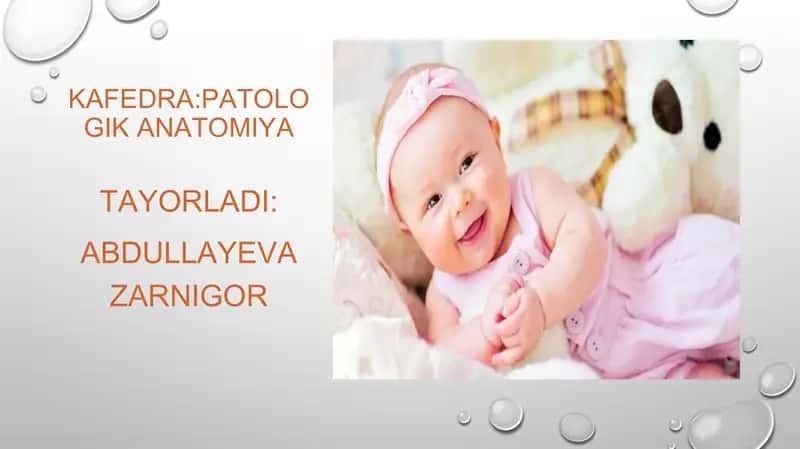 To'satdan Bolalar Ulimi Sendromi