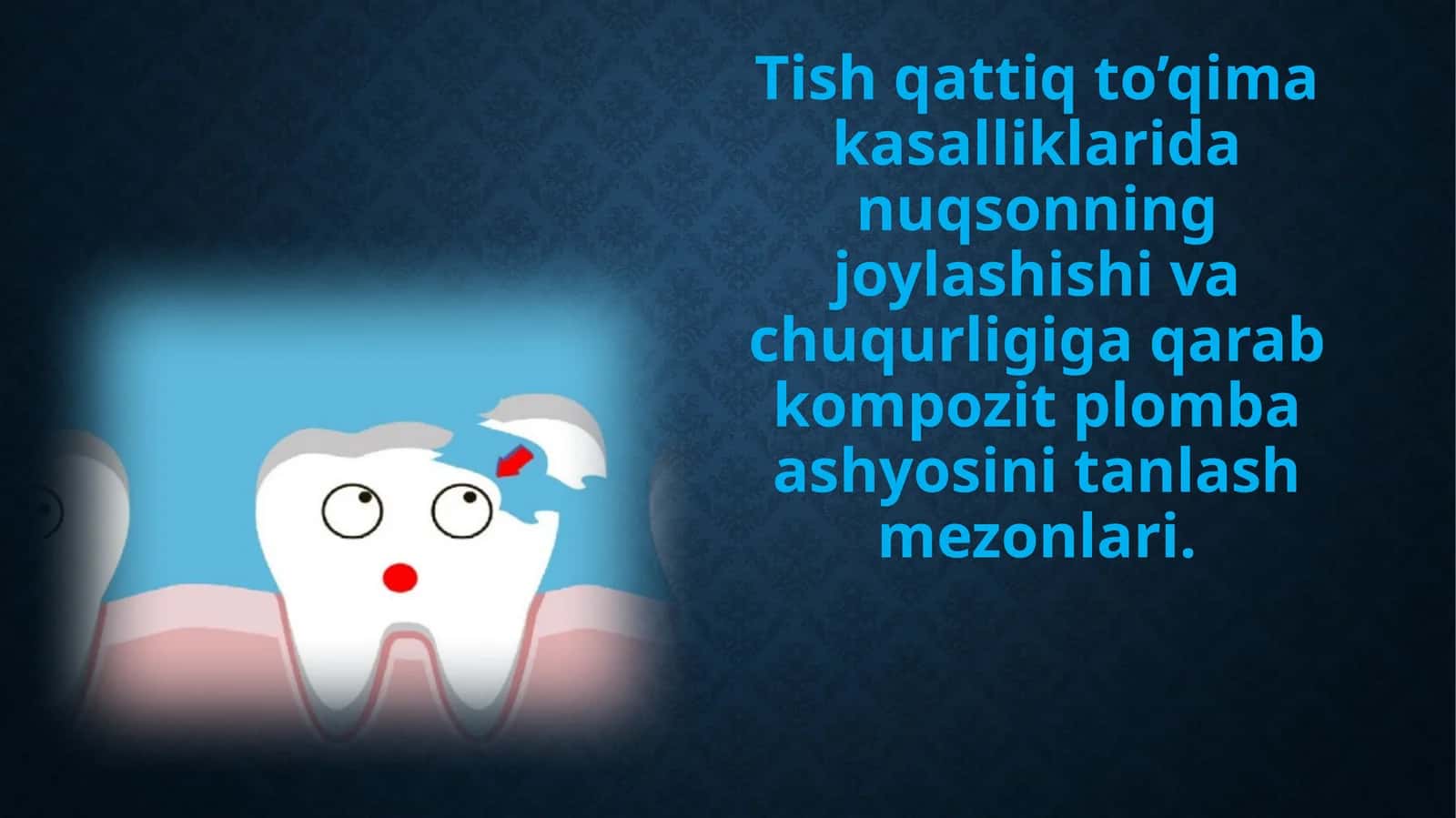 Tish qattiq to'qimalaridan nuqsonning joylashishi va chuqurligiga qarab kompozit plomba ashyosini tanlash mezonlari