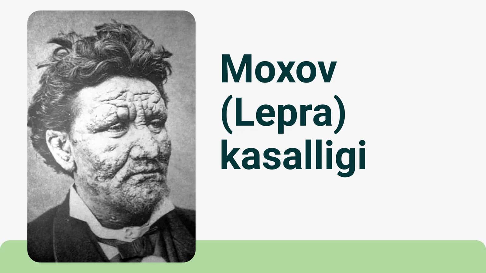 Mohov Lepra kasalligi