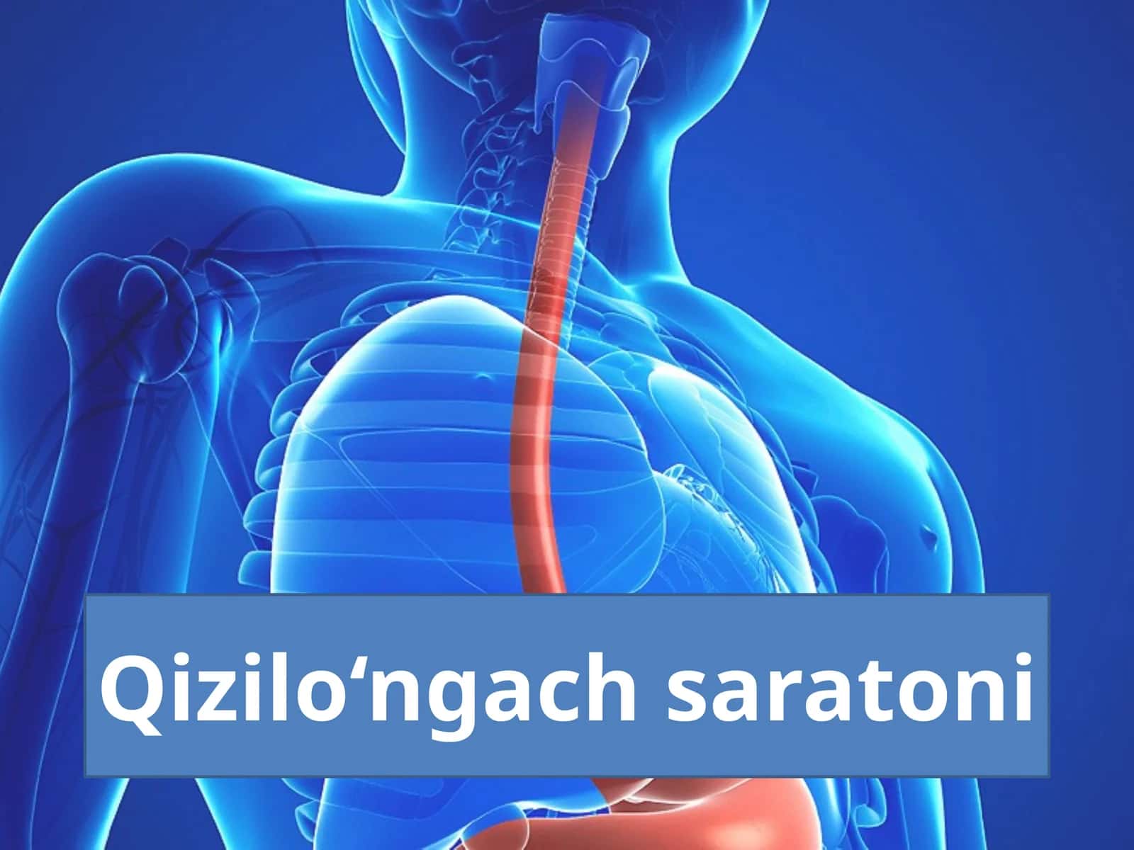 Qizilo‘ngach saratoni