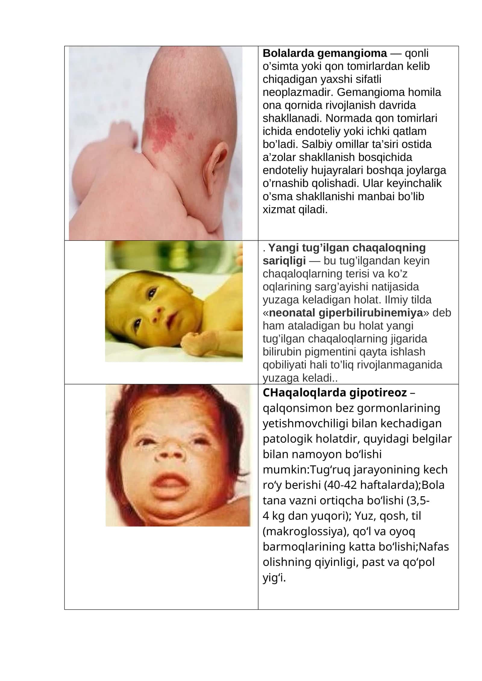 Neonatal Giperbilirubinemiya