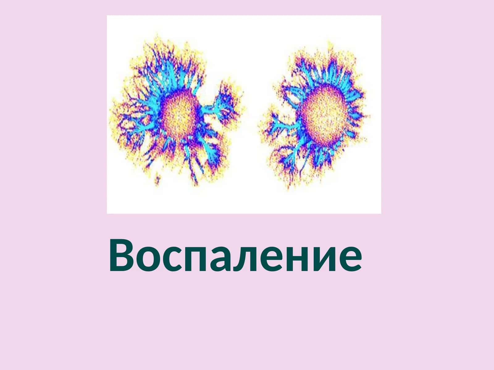 Воспаление