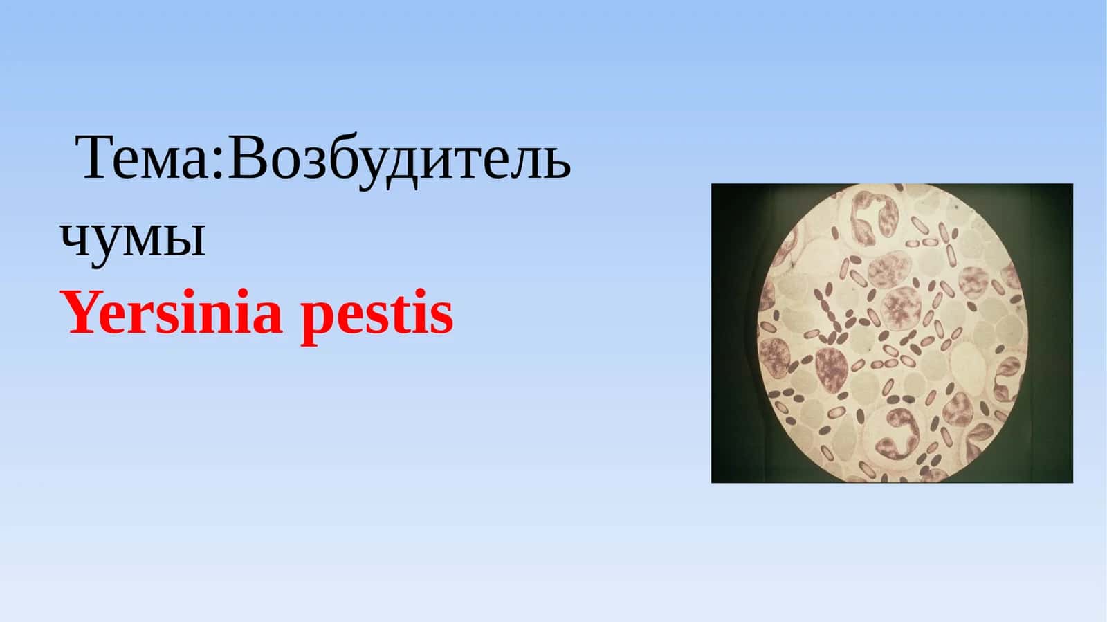 Тема:Возбудитель чумы