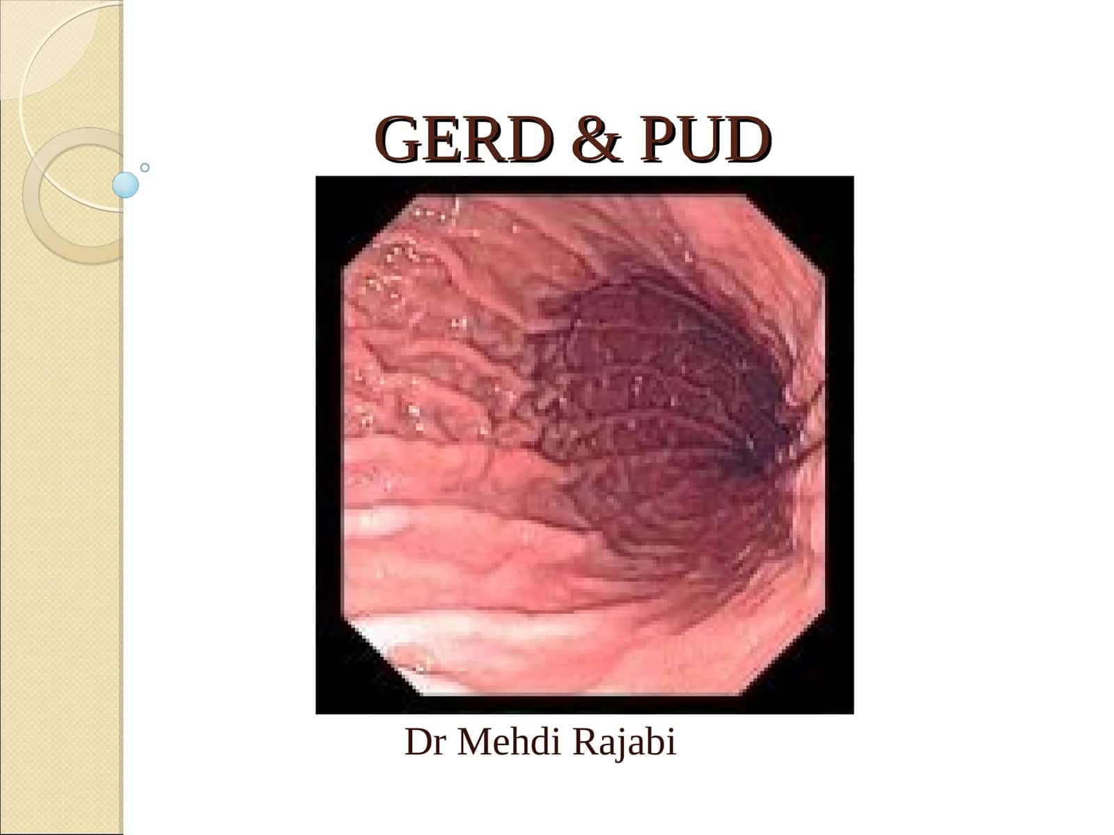 GERD & PUD
