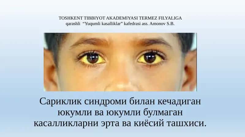 Сариклик синдроми билан кечадиган юкумли ва юкумли булмаган касалликларни ертава киёсий ташхиси