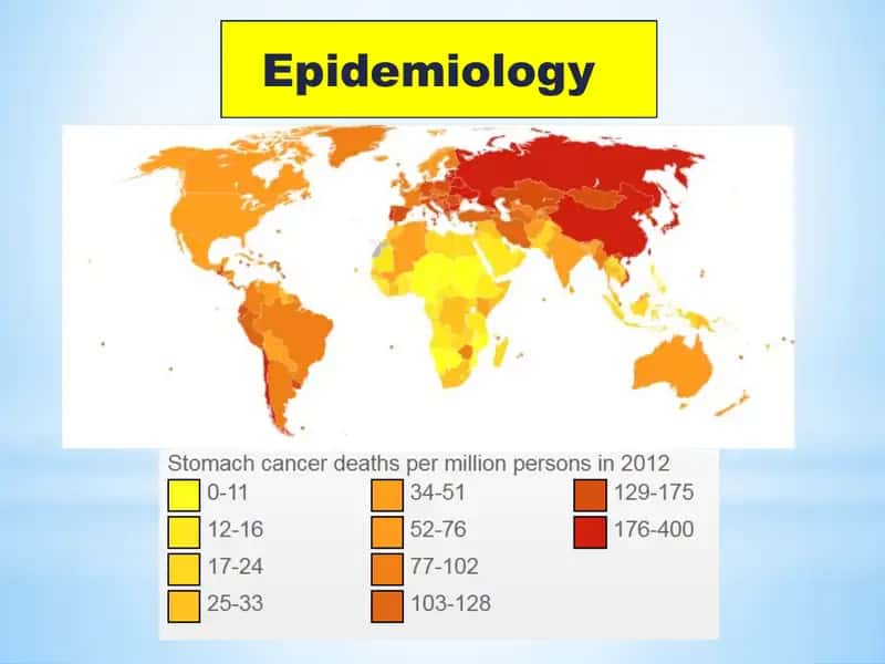 Epidemiologiya