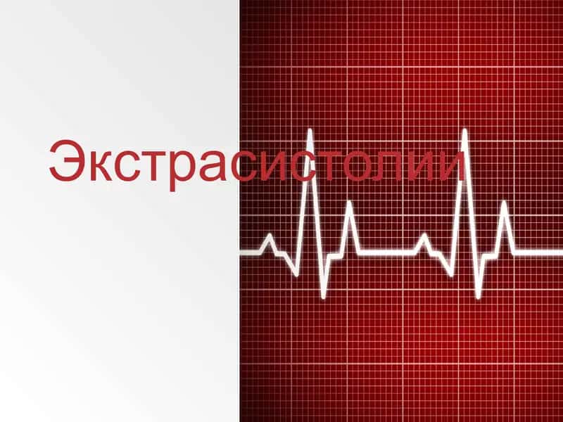 Экстрасистолии