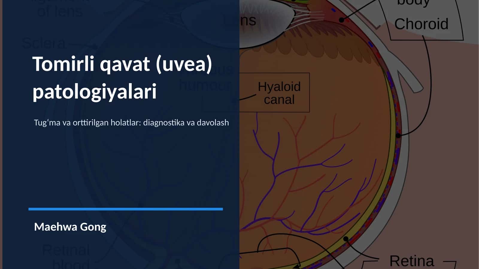 Tomirli qavat (uvea)