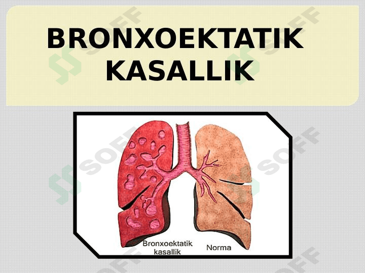 BRONXOEKTATIK KASALLIK